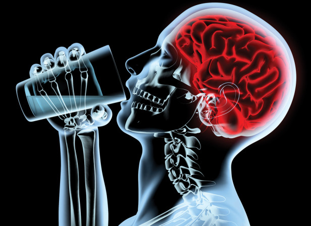 X - ray brain