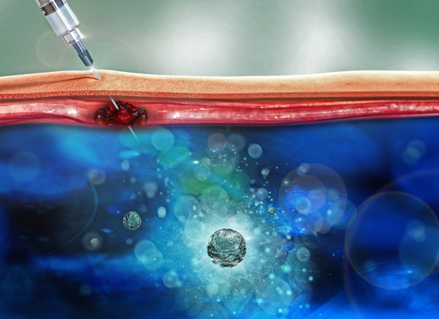 Medical Test Injection