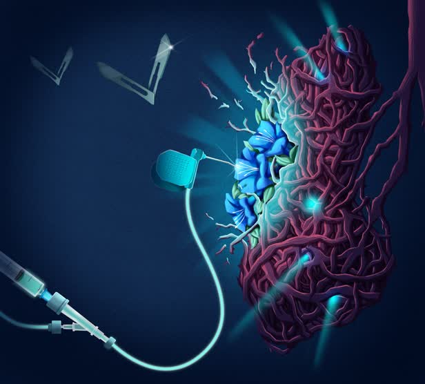 Pleurectomy_JuneCover_TheLancetRespiratoryMedicine.jpg