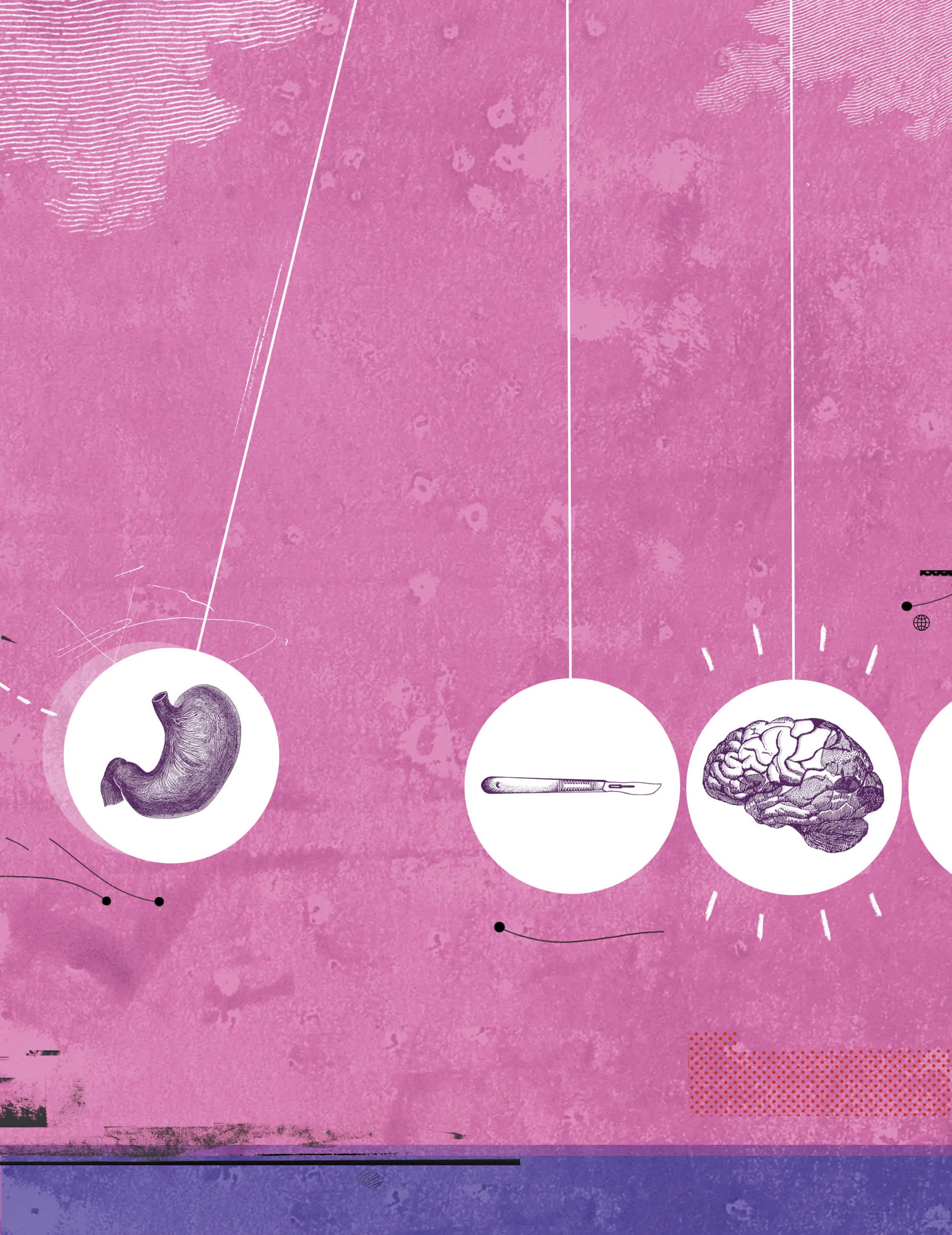 Stomach brain relationship.jpg
