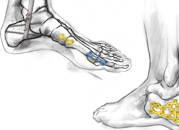 Ortho Soultions