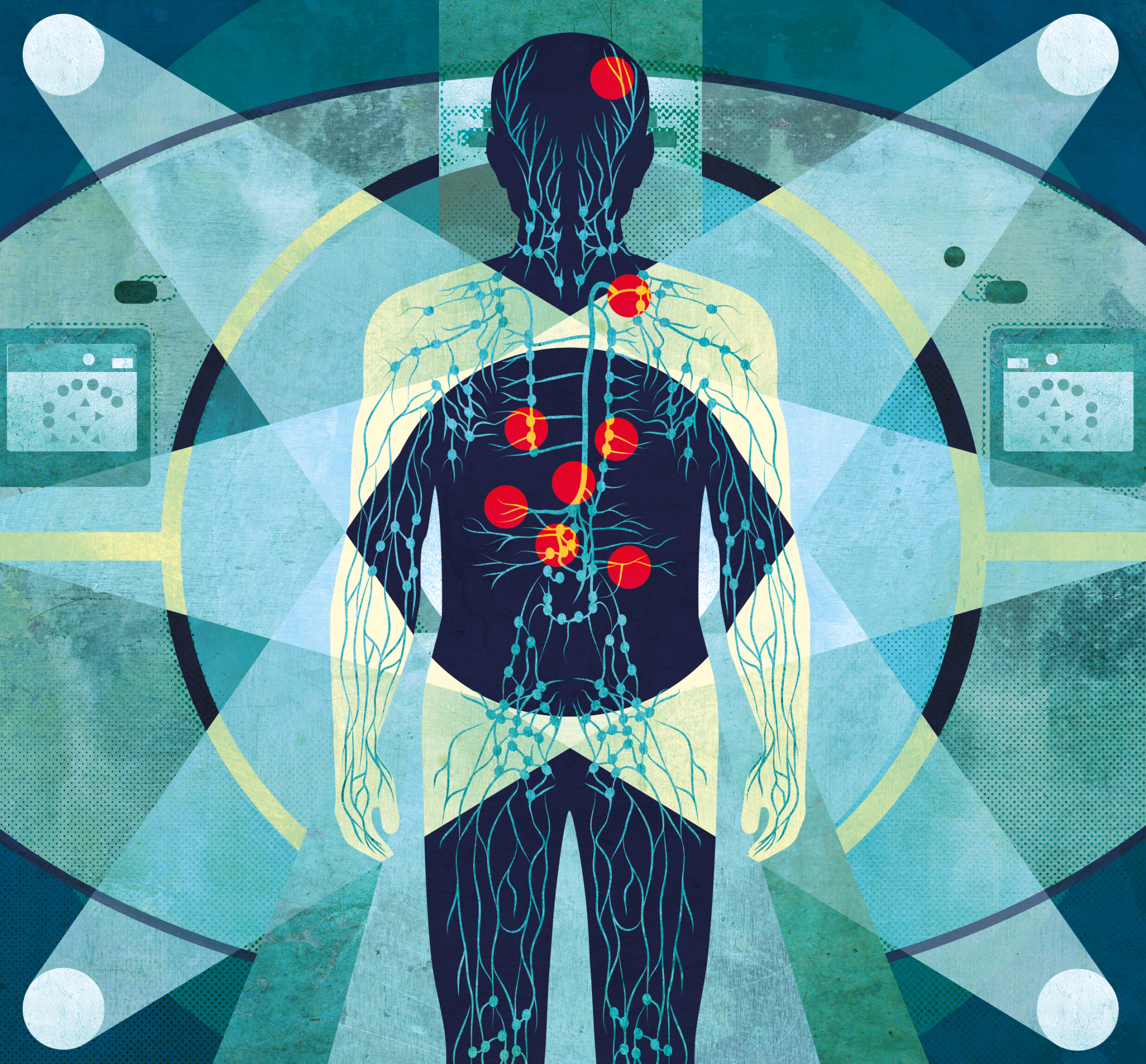 PET Scans - The Lancet Oncology.jpeg