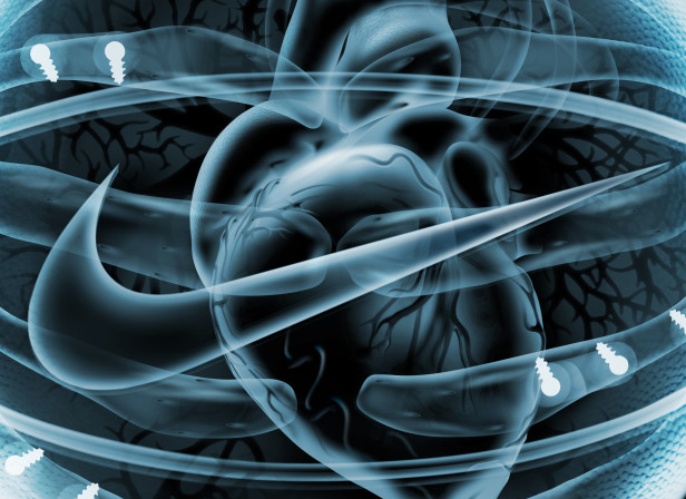 X-Ray Nike