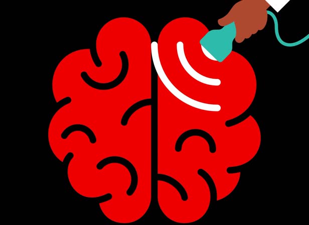 Brain-ultrasound_Atlanta-Mag.jpg