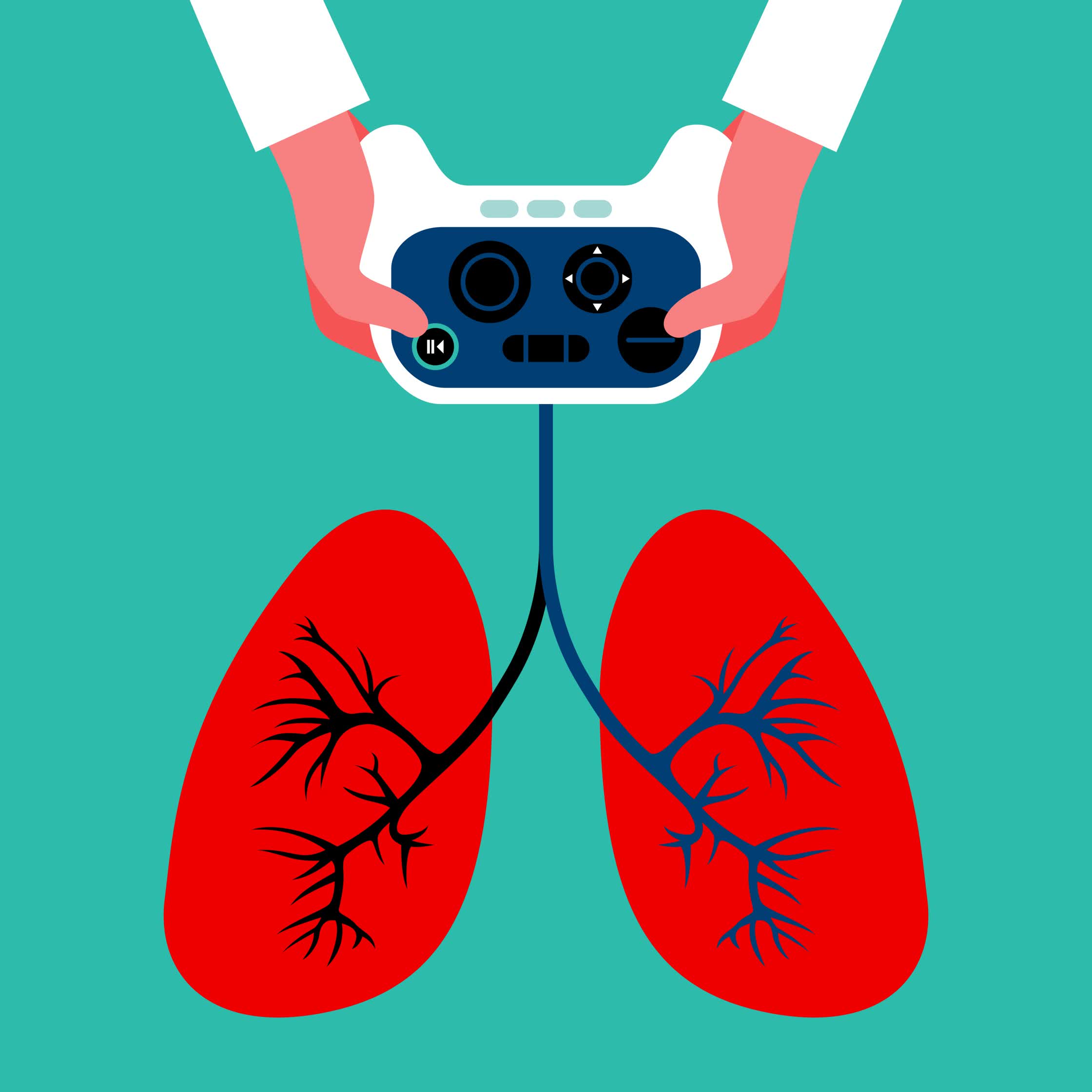 Lung-bronchoscopy_Atlanta-Mag.jpg